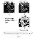 Fig. 02 - Pyrazolopyridazines and methods for treating retinal-degerative diseases and hearing loss associated with usher syndrome