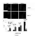 Fig. 02 - Compositions and Methods for Treating Myotonic Dystrophy Type 1
