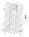 Fig. 03 - Shape memory polymer