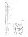 Fig. 02 - Intracavitary Brachytherapy Device for Insertion in a Body Cavity and Methods of Use Thereof