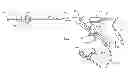Fig. 01 - Lithotripsy apparatus using a flexible endoscope
