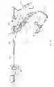 Fig. 02 - Lithotripsy apparatus using a flexible endoscope