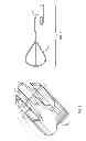 Fig. 04 - Lithotripsy apparatus using a flexible endoscope