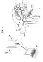 Fig. 02 - Finger clip for prostate glove