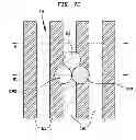 Fig. 09 - Finger clip for prostate glove