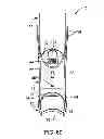 Fig. 41 - PIEZOELECTRIC, MICRO-EXERCISE APPARATUS AND METHOD
