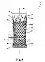Fig. 02 - Intraluminal device and method with enhanced anti-migration