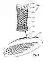 Fig. 06 - Intraluminal device and method with enhanced anti-migration