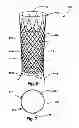 Fig. 07 - Intraluminal device and method with enhanced anti-migration