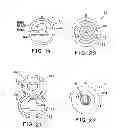 Fig. 07 - Tool for adjusting an implantable adjustable fluid flow control valve