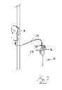 Fig. 04 - INSUFFLATION SYSTEM