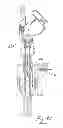 Fig. 32 - INSUFFLATION SYSTEM