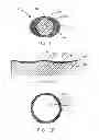 Fig. 02 - Apparatus and methods for coating medical devices
