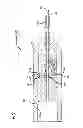 Fig. 02 - Catheter needle tip shielding device