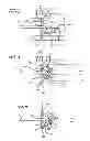 Fig. 03 - Catheter needle tip shielding device
