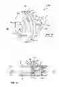 Fig. 04 - Catheter needle tip shielding device