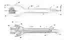 Fig. 01 - Irrigation sleeve and phacoemulsification needle with sleeve retention features