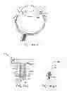 Fig. 03 - Implantable therapeutic device