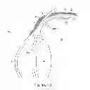 Fig. 04 - Implantable therapeutic device