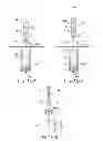 Fig. 06 - Implantable therapeutic device