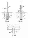 Fig. 09 - Implantable therapeutic device
