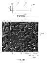 Fig. 12 - Implantable therapeutic device