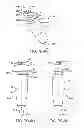 Fig. 28 - Implantable therapeutic device