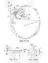 Fig. 30 - Implantable therapeutic device