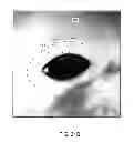 Fig. 70 - Implantable therapeutic device