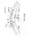 Fig. 77 - Implantable therapeutic device