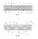 Fig. 05 - Shaped fastening systems for use with absorbent articles