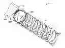 Fig. 01 - Elastic introducer sheath