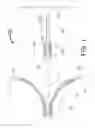 Fig. 02 - Transvascular catheter for extravascular delivery