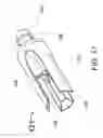 Fig. 16 - Transvascular catheter for extravascular delivery