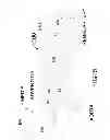 Fig. 07 - Transvascular methods of treating extravascular tissue