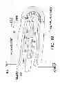 Fig. 09 - Transvascular methods of treating extravascular tissue
