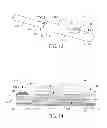Fig. 08 - Laser probe tip
