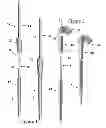 Fig. 02 - Method and Apparatus for Preparing Bone for a Prosthetic Device