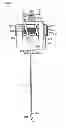 Fig. 01 - Delivery of apparatus and methods for vertebrostenting