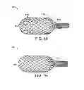 Fig. 02 - Delivery of apparatus and methods for vertebrostenting