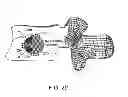 Fig. 07 - Delivery of apparatus and methods for vertebrostenting