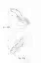 Fig. 06 - Surgical instrument and method of using same