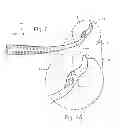 Fig. 07 - Surgical instrument and method of using same