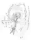 Fig. 08 - Surgical instrument and method of using same