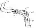 Fig. 01 - Thrombectomy device with distal protection