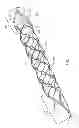 Fig. 02 - Thrombectomy device with distal protection