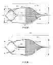 Fig. 03 - Thrombectomy device with distal protection