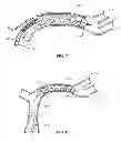 Fig. 06 - Thrombectomy device with distal protection