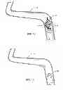 Fig. 09 - Thrombectomy device with distal protection