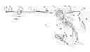 Fig. 01 - Impact lithotripsy tip